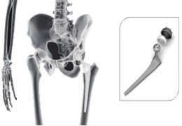 Inner Bore of Medical Ceramic Hip Grinding